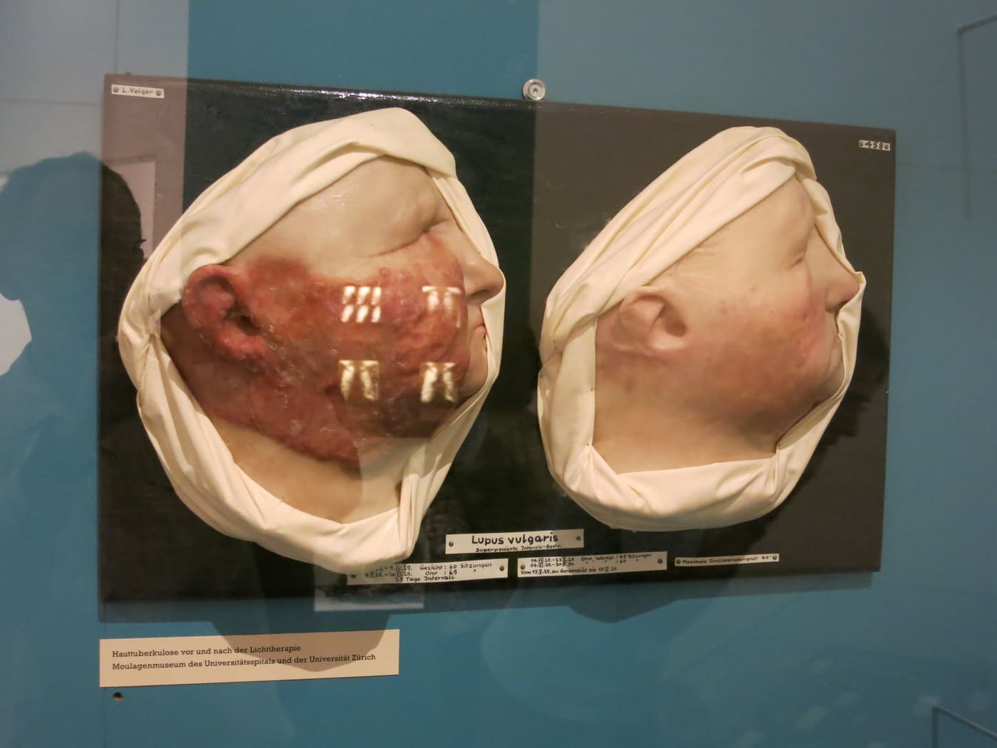 museum of wax moulages